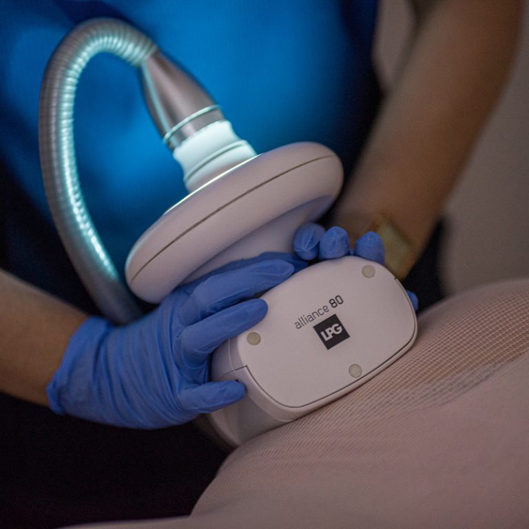 Endermologia LPG -- VS Akademia Urody Łódż Złotno 7